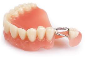 Dantų protezavimas – inovatyvi technologija, kurios dėka atkuriami prarasti dantys