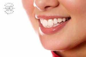 Dantų balinimas lazeriu odontologijos klinikoje ANGITIA