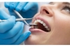 Profesionali burnos higiena dar geresnei sveikatai