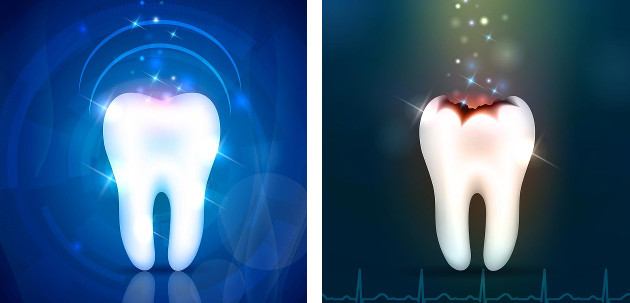 Dantų šaknų kanalų gydymas ir pergydymas odontologijos klinikoje Kaune