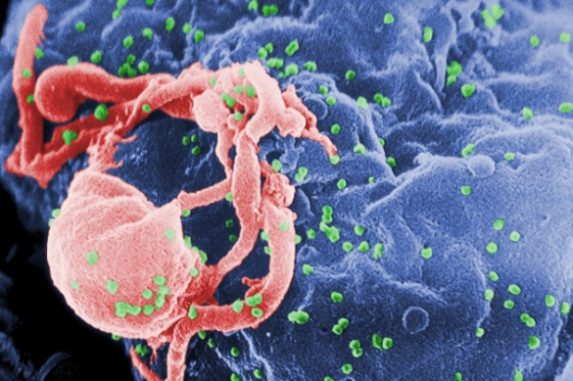 ŽIV virusas