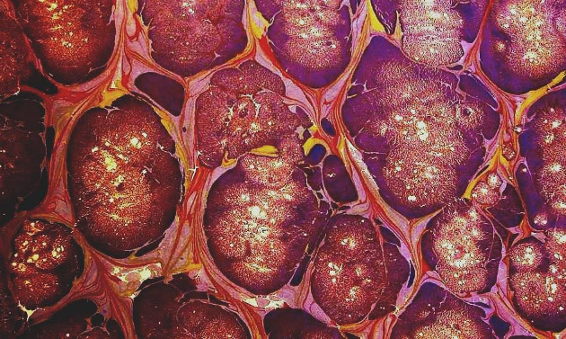 Ebru menas – tapyba ant vandens
