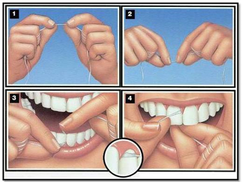 Profesionali burnos higiena: kodėl ji reikalinga?