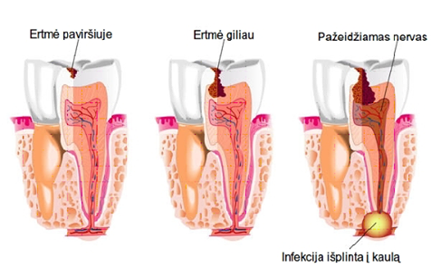 Odontologijos klinika ryklio dantis