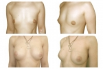 PLASTINĖ IR REKONSTRUKCINĖ CHIRURGIJA - plastikos chirurgo paslaugos: krūtų didinimas, mažinimas ir pakėlimas, riebalų nusiurbimas, kūno modeliavimas