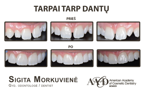 PRODENTAS, UAB - estetinės odontologijos klinika: visos odontologų paslaugos, dantų gydymas, tiesinimas, estetinis plombavimas