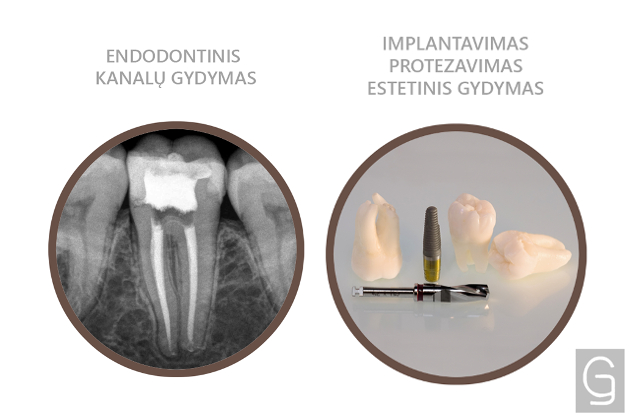 G.Janužio odontologijos klinika MedProject, UAB - įvairiapusis odontologinis gydymas, dantų protezavimas, implantavimas, ortodontinis gydymas