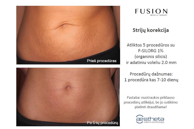 Estetinės kosmetologijos ir dermatologijos centras AESTHETA, UAB -  veido ir kūno procedūros, profesionalios ir dermatologinės kosmetikos pardavimas