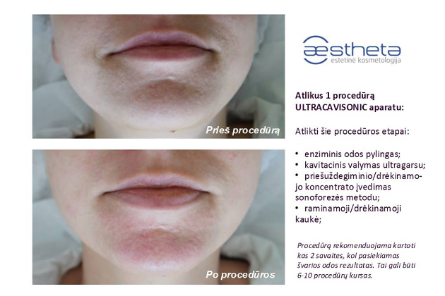 Estetinės kosmetologijos ir dermatologijos centras AESTHETA, UAB -  veido ir kūno procedūros, profesionalios ir dermatologinės kosmetikos pardavimas