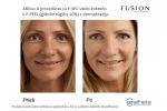 Estetinės kosmetologijos ir dermatologijos centras AESTHETA, UAB -  veido ir kūno procedūros, profesionalios ir dermatologinės kosmetikos pardavimas