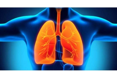 Tuberkuliozė – pagrindiniai faktai apie šią ligą
