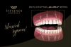 Visi vieno žandikaulio dantys tik ant keturių implantų nuo 3999 eur
