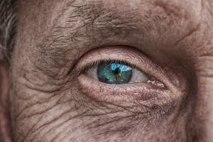 Kokios akių ligos vyresniame amžiuje kėsinasi atimti regėjimą?