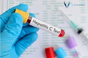 Hepatitas C – kada verta susirūpinti?