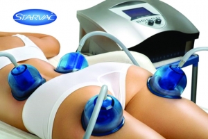 Anticeliulitinis vakuuminis STARVAC masažas + kineziterapija – vasaros pasiūlymas stangriam užpakaliukui
