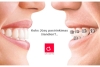 Dantų tiesinimas odontologijos klinikoje ALFADENTA